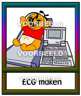 ECG maken